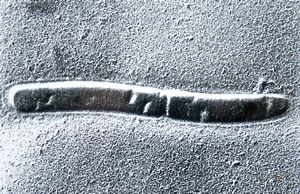 oral saprophytic bacterial flora oral saprophytic bacterial flora